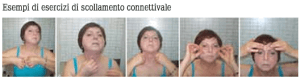 Scollamento connettivale